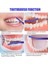 Yeşil Stil Ortodontik Diş Fırçaları Çift Uçlu Interdental Fırça V Trim Uçlu Yumuşak Tuft Diş Fırçası Orto Braces 3 Renk Tepeli Diş Fırçası (Yurt Dışından) 5