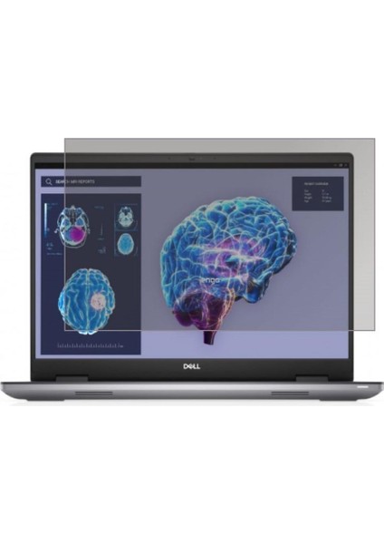 Dell Precision M7680 16 Inç Hayalet Ekran Koruyucu 16:10