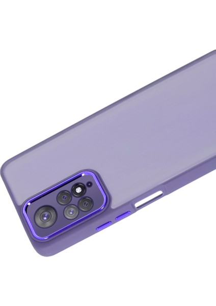 Xiaomi Redmi Note 11 Pro 4g Kılıf Freya Lazer Lens Kamera Çerçeveli Silikon Kapak fiyatları