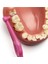 Angle Pembe Arayüz Fırçası 0.4mm 7317400011479 2
