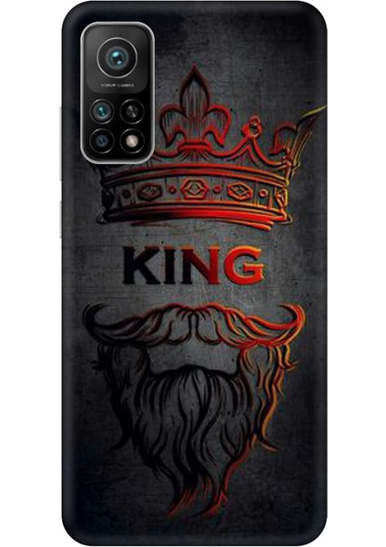 Mi 11 Kaplama King