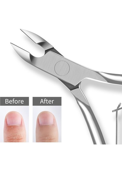 Tırnak Eti Pense Tırnak Manikür Tırnak Eti Makası Makası Düzeltici Ölü Cilt Sökücü Pedikür Paslanmaz Çelik Kesiciler Aracı (Yurt Dışından) fiyatları