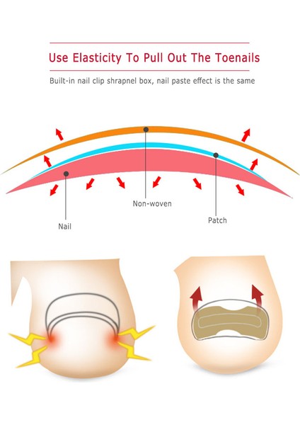 Tırnak Şeritleri Anti-Roll Tırnak Ücretsiz Tutkal Ayak Kakma Tırnak Düzeltici Tırnak Yama Düzeltme Çıkartmalar (Yurt Dışından) fırsatları