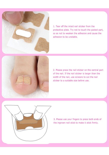 Tırnak Şeritleri Anti-Roll Tırnak Ücretsiz Tutkal Ayak Kakma Tırnak Düzeltici Tırnak Yama Düzeltme Çıkartmalar (Yurt Dışından) indirimleri
