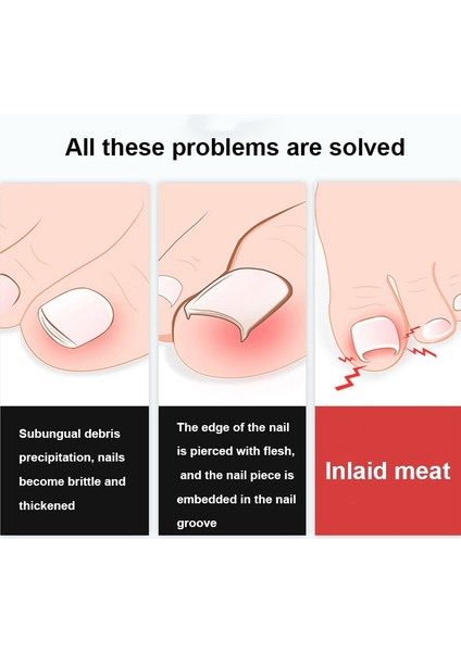 Tırnak Makası Kesiciler Batık Ayak Tırnağı Araçları Pedikür Manikür Olecran Profesyonel Kalın Paronişi Düzeltme Aracı Dropshipping (Yurt Dışından) indirimleri