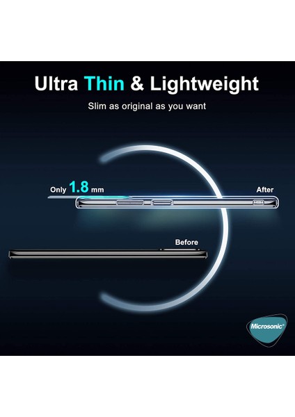 Xiaomi Redmi 9t Kılıf Transparent Soft Beyaz