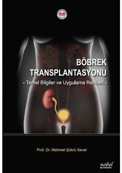 Böbrek Transplantasyonu: Temel Bilgiler ve Uygulama Rehberi - Mehmet Şükrü Sever