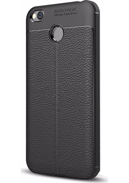 Xiaomi Red Mi 4x Kılıf Niss Silikon Deri Görünümlü Siyah