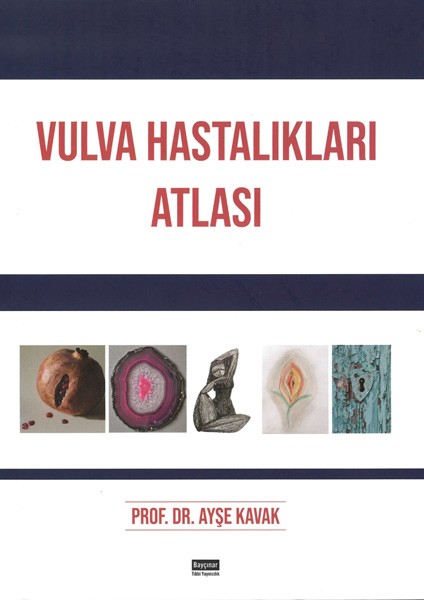 Vulva Hastalıkları Atlası - Ayşe Kavak