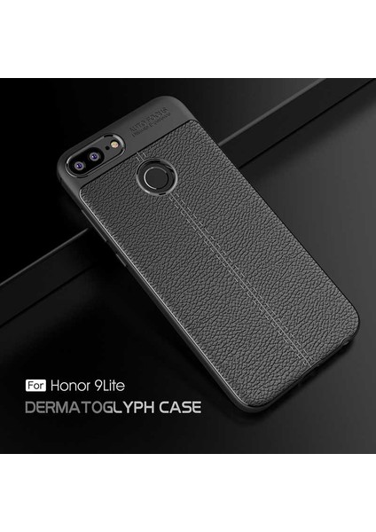 Huawei Honor 9 Lite Kılıf Deri Görünümlü Renk Atmayan Dayanaklı Silikon Kapak (Niss) modelleri
