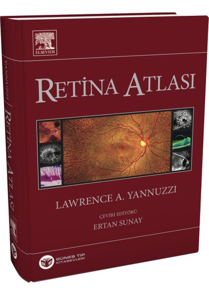 Yannuzzi Retina Atlası