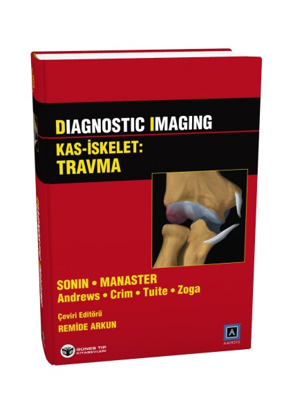 Diagnostic Imaging - Kas İskelet: Travma