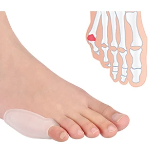 Peak Bays Serçe Parmak Bunyon Koruyucu (2 Adet) V22