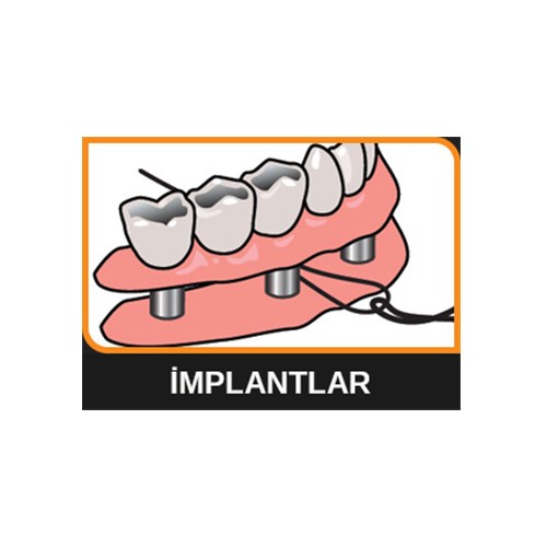 İdontix X Threaders Fiyatı, Taksit Seçenekleri ile Satın Al