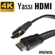 IRENIS 4K Yassı HDMI 2.0 Kablo 4K 60Hz - 50 cm