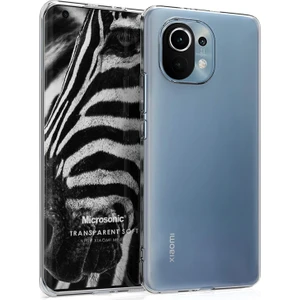 Xiaomi Mi 11 Kılıf Transparent Soft Beyaz