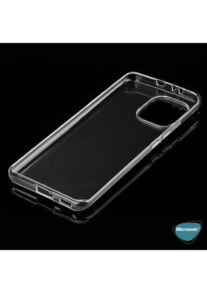 Xiaomi Mi 11 Kılıf Transparent Soft Beyaz