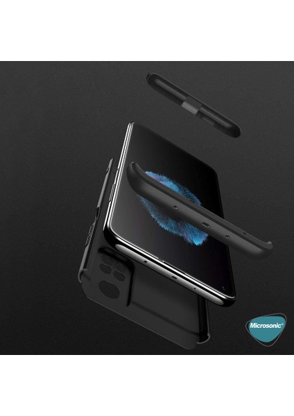 Xiaomi Mi 10T Kılıf Double Dip 360 Protective Mavi