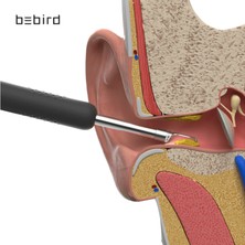Bebird R1 Akıllı Görüntülü Kulak Temizleme Cihazı Siyah