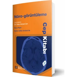 Nöro-Görüntüleme Cep Kitabı - Tuba Selçuk Can