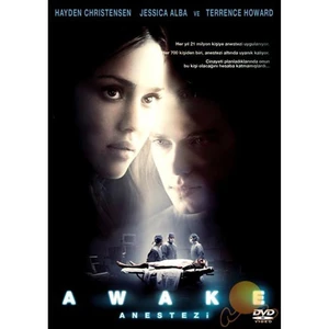 Awake (Anestezi)