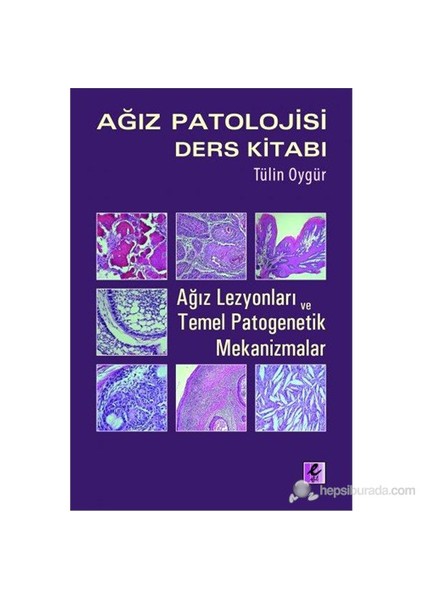 Ağız Patolojisi Ders Kitabı - (Ağız Lezyonları ve Temel Patogenetik Mekanizmalar)