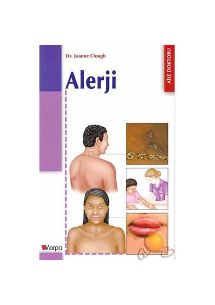 Alerji ( Understanding Allergies )