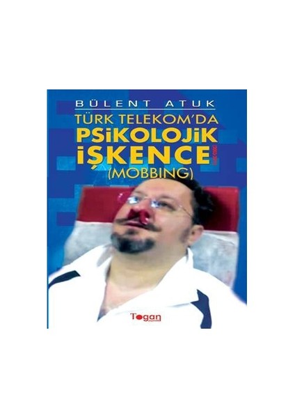 Türk Telekom'Da Psikolojik İşkence-Bülent Atuk