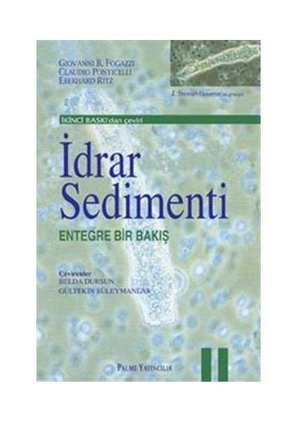 İdrar Sedimenti