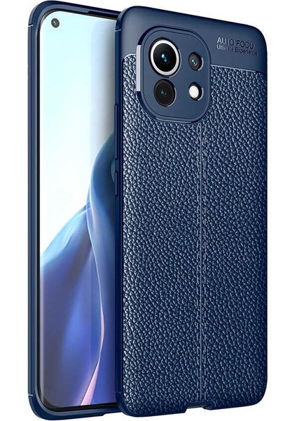 - Xiaomi Mi 11 - Kılıf Auto Focus Karbon Niss Silikon Kapak - Lacivert - T16470