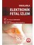 Vakalarla Elektronik Fetal Izlem - Nazan Karahan 1