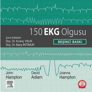 150 Ekg Olgusu - Kıvanç Yalın - Barış Ikitimur