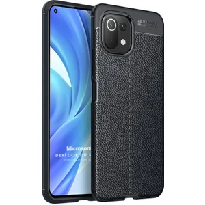 Xiaomi Mi 11 Lite Kılıf Deri Dokulu Silikon Siyah