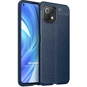 Xiaomi Mi 11 Lite Kılıf Deri Dokulu Silikon Lacivert