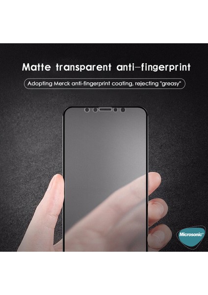 Xiaomi Redmi Note 10S Seramik Matte Flexible Ekran Koruyucu Siyah