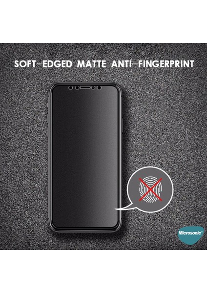 Xiaomi Redmi Note 10S Seramik Matte Flexible Ekran Koruyucu Siyah