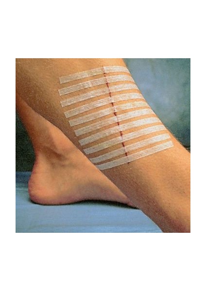 Omnistrip Steri Strip Dikiş Bandı 12X101MM 10PAKET fiyatları