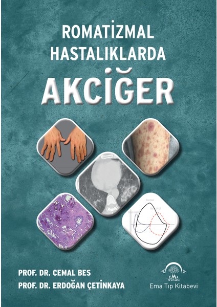 Romatızmal Hastalıklarda Akciğer - Cemal Bes - Erdoğan Çetinkaya