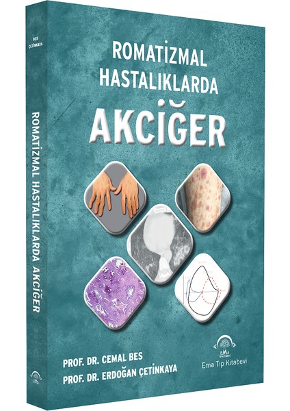 Romatızmal Hastalıklarda Akciğer - Cemal Bes - Erdoğan Çetinkaya fiyatları