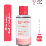 Akne Karşıtı Losyon 30ml – Akne Yatıştırıcı, Siyah Nokta Azaltıcı Vegan (%5 Calamine – Yeşil Çay)