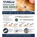 Yangj 2'li Kene Çıkarma Alet Seti,çoğu Evcil Hayvan Için Uygun Paslanmaz Çelik