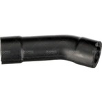 Rapro 28617 Pipo Hortum M102 W124 W201 1985 1992 1020942187
