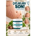 Olivia Wilson Sıkılaştıcı Çatlak Giderici Vücüt Şekillendirici Çatlak Ktemş