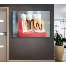 Caddeko Ağız ve Diş Polikliniği, Dişçi Tabloları Dekoratif Diş, Dekoratif Dişçi, Dişçi Dekorasyonu DSC187