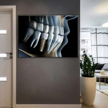 Caddeko Ağız ve Diş Sağlığı Polikliniği Tabloları Dekoratif Diş, Dekoratif Dişçi, Dişçi Dekorasyonu Dsc-35