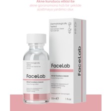 Facelab Akne Ve Sivilce Kurutmaya Yardımcı Zencefil Özlü Losyon - Acne Drying Lotion 30 Ml