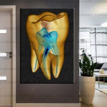 Caddeko Ağız ve Diş Sağlığı Polikliniği Tabloları Dekoratif Diş, Dekoratif Dişçi, Dişçi Dekorasyonu DSC-132