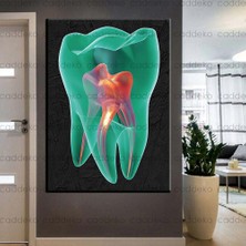 Caddeko Ağız ve Diş Sağlığı Polikliniği Tabloları Dekoratif Diş, Dekoratif Dişçi, Dişçi Dekorasyonu DSC-145