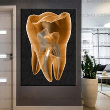 Caddeko Ağız ve Diş Sağlığı Polikliniği Tabloları Dekoratif Diş, Dekoratif Dişçi, Dişçi Dekorasyonu DSC-131