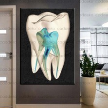 Caddeko Ağız ve Diş Sağlığı Polikliniği Tabloları Dekoratif Diş, Dekoratif Dişçi, Dişçi Dekorasyonu DSC-142